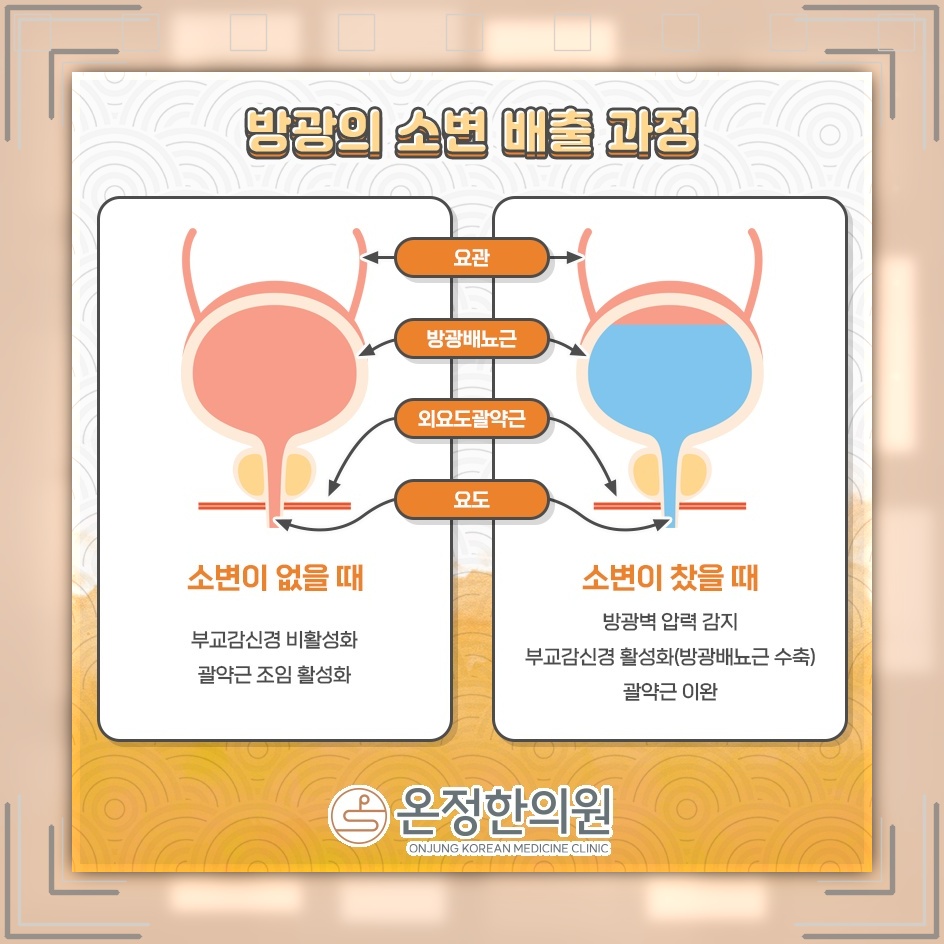 골반저근 기능 저하와 요실금이 함께 나타나는 배경