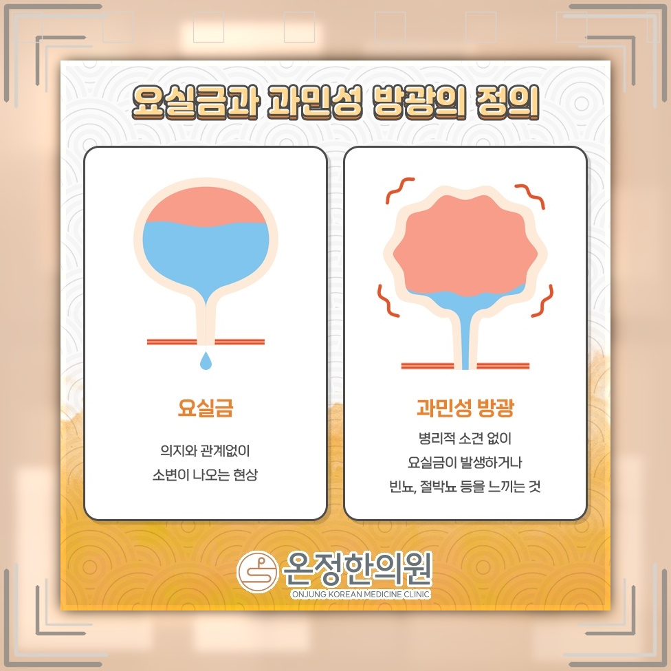 골반저근 기능 저하와 요실금이 함께 나타나는 배경